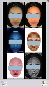 Système <span class=keywords><strong>de</strong></span> diagnostic cutané Meicet RESUR MC2400 2023, appareil d'analyse <span class=keywords><strong>de</strong></span> la peau avec caméra 18 millions <span class=keywords><strong>de</strong></span> pixels pour les médecins professionnels en milieu hospitalier - Product Image 6