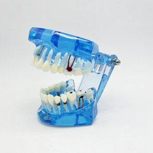 Modèle de réparation bleu école de médecine restauration des nerfs dentaires modèle humain modèle dentaire médical - Product Image 3