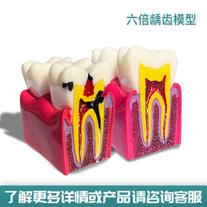 Modelo de Implante Dental de Silicona, Restauración de Patología Nerviosa Removible para Comunicación Completa entre Médico y Paciente - Product Image 2