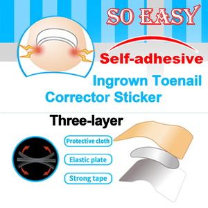 Parches Correctores de Uñas de Alta Calidad OEM al por Mayor, Adhesivos para el Tratamiento de Hongos en las Uñas de los Pies, para la Corrección de Uñas, Set de <span class=keywords><strong>Manicura</strong></span> y Pedicura - Product Image 4