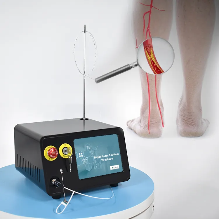 Hot bán 1470nm Diode Laser để điều trị giãn tĩnh mạch mạch bệnh mạch máu