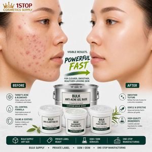 <span class=keywords><strong>Crema</strong></span> de Aloe Vera para Piel Propensa al Acné, Hidratante, Blanqueadora, Sin Reseñas Aún, Privado - Product Image 1