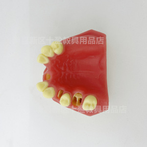 แบบจำลองฟันปลอมชิอิง รุ่น Pim-21 ทำจากเรซิ่น สำหรับฝึกปฏิบัติทางการแพทย์วิทยาศาสตร์ ช่องปากส่วนหนึ่ง - Product Image 1