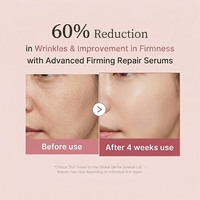 PINNSKIN Ampoule de PDRN de saumon haute pureté 99% Soin coréen de la peau Sérum anti-âge Ampoules hydratantes pour le visage 10 pièces