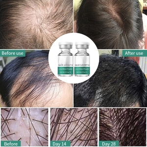 Sérum capillaire biologique nourrissant le cuir chevelu au GHK-Cu, réduit la chute des cheveux, poudre lyophilisée, biotine, collagène, peptide de cuivre, cosmétique - Product Image 4