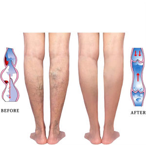 Vente flash : <span class=keywords><strong>chaussettes</strong></span> de compression à fermeture éclair <span class=keywords><strong>pour</strong></span> les varices, soutien gradué de 20 à 30 mmHg, hauteur genou, <span class=keywords><strong>pour</strong></span> soulager les gonflements - Product Image 6