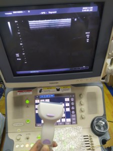 Servicio de Reparación y Reemplazo para Escáner de Ultrasonido <span class=keywords><strong>Toshiba</strong></span> PLT-1204AT SSA-660A Xario, Usado en Animales - Product Image 1