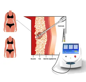 Latest Endoscopic 980nm Diode Laser Face Lifting Liposuction Machine Facial Laser Skin Tightening plastic surgery equipment