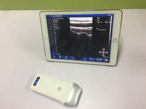 Mesin medis USG Linear Genggam kualitas tinggi, pemindai <span class=keywords><strong>Ultrasound</strong></span> portabel nirkabel IOS Android <span class=keywords><strong>Ultrasound</strong></span> Linear - Product Image 4