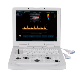 Tragbares veterinär medizinisches diagnostisches Farbdoppler-Ultraschall gerät E2 3D/4D/5D Medizinisches Instrument - Product Image 1