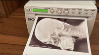 Papel Térmico para Ultrasonido de Grado Médico – Imagen Negra de Alta Definición