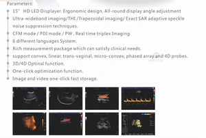 TC15 mesin <span class=keywords><strong>Ultrasound</strong></span>, sistem diagnostik Digital penuh <span class=keywords><strong>3D</strong></span> 4D Trolly warna - Product Image 6