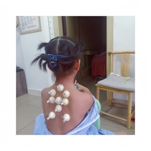 Cono de Moxa de Trigo SI JI QI AI para Diversas Enfermedades Aceite de Humo que Desobstruye los Meridianos, Alivia <span class=keywords><strong>el</strong></span> Dolor y Elimina la Humedad. Calor Suave y Profundo - Product Image 6