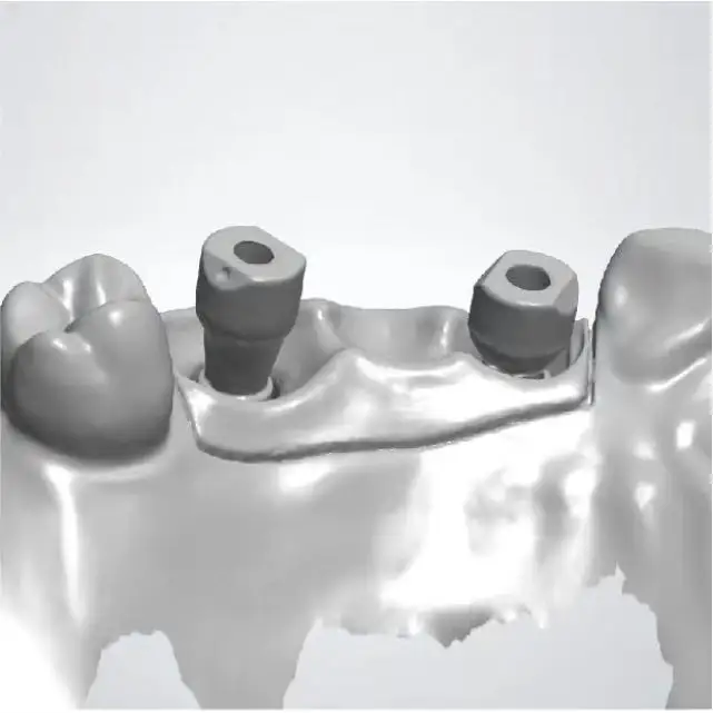 Équipement d'images dentaires de type Medit, Scanner intrabuccal 3D