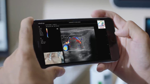 Mindray <b>Ultrasound</b> Mindray MX6 Portable Full Digital <b>Ultrasound</b> Equip with Wireless Function VterinaryUltrasound - Product Image 4