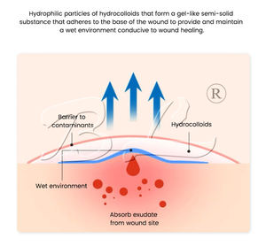 Pembalut hidrokoloid luka sensitif rendah pembalut hidrokoloid - Product Image 4