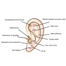 Nouvelle Tendance 2026 : 20 graines auriculaires en titane avec ruban adhésif transparent pour massage et thérapie des points d'acupuncture auriculaires à domicile - Product Image 5