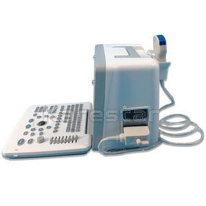 Échographie humaine haute définition spéciale pour la machine à ultrasons d'imagerie multi-parties des cliniques externes des hôpitaux - Product Image 3