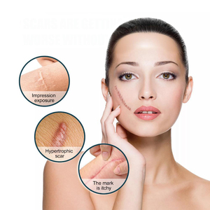 Nhãn Hiệu Riêng Thoải Mái Silicone Sẹo Các Bản Vá Lỗi & Sẹo Băng Cho Loại Bỏ Vết Sẹo Phục Hồi Chức Năng Điều Trị Nguồn Cung Cấp - Product Image 2