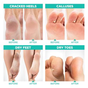 Venta al por mayor de mascarilla para los pies, exfoliante Peel Off callos piel muerta removedor de callos, bebé suave al tacto pies-Hombres Mujeres - Product Image 4