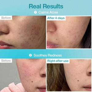 Masque réparateur pour le visage No.1 Panthenol B5 + Acide hyaluronique (5 pièces) - Hydratation intense et réparation de la barrière cutanée pour les peaux sensibles et sèches - Product Image 5