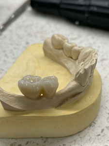 Tandheelkundige Keramische Kunstgebit Tandheelkundige Zirkonia Blanks Circonio Dentale - Product Image 5