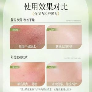 Gel de Aloe Vera Beilingmei 300g Crema Facial Hidratante Para el Cuidado de la Piel - Product Image 5