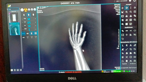 Careray-Detector de panel plano digital <span class=keywords><strong>Dr</strong></span>, software multilenguaje, equipo de radiología, accesorios careview 1500cw 1800cw - Product Image 6