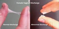 Gel Intime Resserrant et Blanchissant les Lèvres Vaginales, Gel Lubrifiant Réparateur d'Hymen, Réduction du Yoni – Vente Chaude en Gros