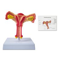 Modelo Anatómico Realista de Órganos Femeninos a Tamaño Real, Útero y Ovario, para la Enseñanza de Ciencias Médicas