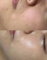 Sérum Visage Anti-Âge Hydratant Sûr à la Niacinamide et à la Boseine 30ml Marque Blanche pour Resserre les Pores et Éclaircit Naturellement