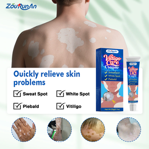 ZouRunAn krim penghilang Vitiligo, perawatan pigmentasi untuk kerusakan matahari, mengurangi noda & pengencangan warna kulit, perbaikan mendalam - Product Image 2