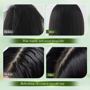 Sadoer tự nhiên tùy chỉnh nhãn hiệu riêng chống gàu sản phẩm tóc bưởi hữu cơ Hạt giống hoa Trà dầu gội tóc và điều hòa - Product Image 6