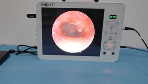 กล้องตรวจหูแบบวิดีโอแนวตั้ง ชุดอุปกรณ์วินิจฉัยทางหู คอ จมูก ขนาด 17 นิ้ว - Product Image 6