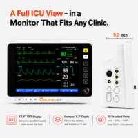 Moniteur patient vétérinaire portable multiparamètres OliveVet à écran tactile 12,1 pouces rechargeable ECG SpO2 NIBP Resp Temp