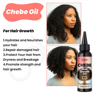 น้ำมันใส่ผมเชเบ้ แบรนด์ส่วนตัว 100 มล. น้ำมันบำรุงเส้นผมสำหรับใช้ทุกวัน ลดการหลุดร่วงของเส้น<span class=keywords><strong>ผม</strong></span> เสริมความแข็งแรงให้เส้นผม - Product Image 6