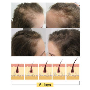 EELHOE-Barra de champú de jengibre para el crecimiento del cabello, jabón calmante para el cuero cabelludo, pérdida de rotura, prevención, barra de champú sólida para el cabello - Product Image 5