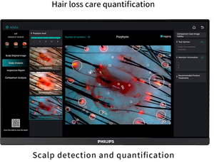 Ai Intelligent Hair Analyzer Scalp Analysis Device Scalp Treatment <b>Machine</b> Hair Growth Scalp <b>Massager</b> Hair Analysis Device - Product Image 4