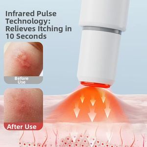 ปากกาบรรเทาอาการคันไฟฟ้าแบบพกพา ชาร์จซ้ำได้ ขายดี - ปลอดภัยสำหรับผู้ใหญ่และเด็ก รักษาอาการถูกแมลงกัด - Product Image 6