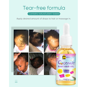 Everythingblack Sultfate Free No Paraben Safety Curly Baby Kids Coconut Oil Hair Care for Moisture and Shine - Product Image 4