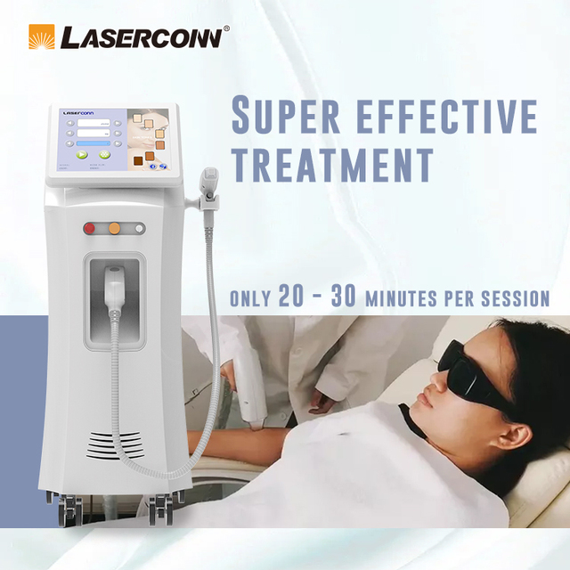 2025 CE Certified Patient Medical Diode Laser Hair Removal Machine 808nm New Standing Laser Competitive Price