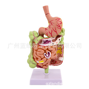 Modelo patológico del colon humano, modelo anatómico gastrointestinal, modelo patológico de colon, cecum, recto y duodeno - Product Image 3