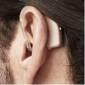 טכנולוגיה מהירה p טכנולוגיה <span class=keywords><strong>4</strong></span> ערוצים דיגיטליים bte חה חה signia - Product Image 3