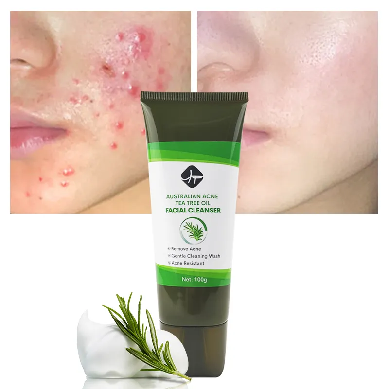 Oem Private Label Hot Sale Tea Tree Goedemorgen Gel Anti Acne Reiniger 100Ml Face Wash Koreaanse Huidverzorging