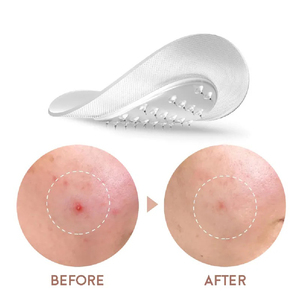 ที่มีคุณภาพสูงบำรุง Microneedle ผิวต่อต้านริ้วรอยกรดไฮยาลูโรละลายภายใต้แพทช์ตาหน้ากาก - Product Image 6
