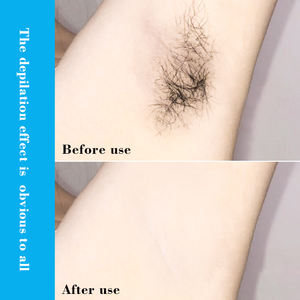 Arrêter la croissance des cheveux inhibiteur de cheveux dissolvant <span class=keywords><strong>mousse</strong></span> crème <span class=keywords><strong>dépilatoire</strong></span> hommes femmes corps épilation permanente Spray pour hommes - Product Image 5
