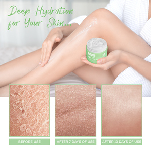 Crème YECUCE OEM 40% Urée + 2% Acide Salicylique, Marque Privée, pour les Pieds et les Mains, Contre les Talons Fissurés et les Callosités, 150g, Logo Personnalisé - Product Image 3