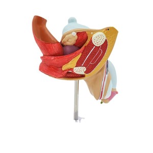 Modelo de patología reproductiva interna masculina; modelo de anatomía reproductiva masculina; modelo de enfermedades del sistema urinario masculino - Product Image 5