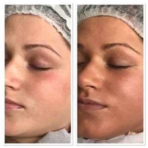 Dermawhite Egf Bb <span class=keywords><strong>Dr</strong></span> <span class=keywords><strong>Pen</strong></span> Ampoule / Korea Foundation Bb/Tratamiento facial blanqueador Bb Cream Serum Makeup - Product Image 6