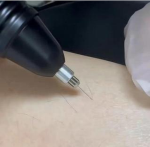 Nouvel appareil d'épilation par électrolyse pour le soin de la peau, épilation permanente, machine d'épilation par électrolyse avec aiguille pour le corps - Product Image 3